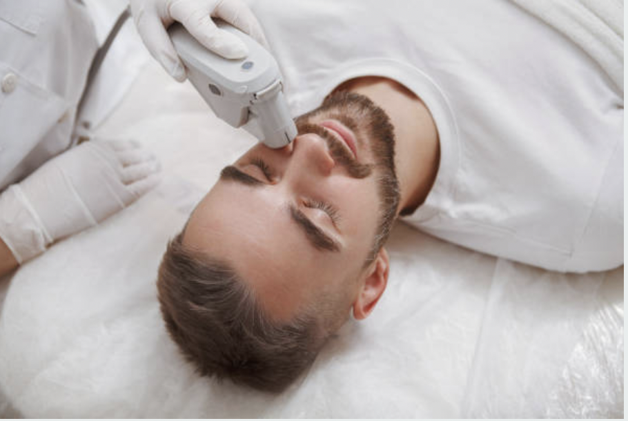 Láser y fotodepilación Hombre zonas S